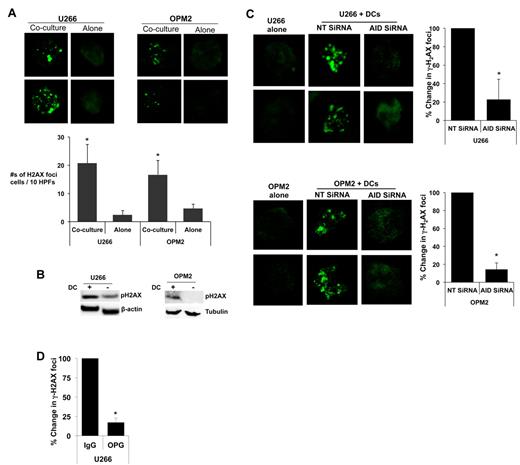 Figure 4. Effect of DC mediated AID induction on genomic instability. (A-B) DC-mediated induction of genomic instability in human MM. (A) MM cells (U266, OPM2) isolated from cocultures with Mo-DCs were analyzed for the presence of γ-H2AX foci by immunofluorescence microscopy indicative of the formation of DNA DSBs. Top panel shows 2 representative nuclei with γ-H2AX foci. Bottom panel shows quantitation of nuclei with γ-H2AX foci in the cytospins. (HPF indicates high-power fields). (B) Lysates from U266 and OPM2 cells were also analyzed by Western blot analysis for the expression of p-H2AX, as a marker for genomic damage. (C) DC-mediated induction of genomic instability is AID dependent. MM cells were electroporated with AID or nontargeting (NT) siRNA (as a control) to inhibit AID before coculture with DCs. Tumor cells were analyzed by immunofluorescence microscopy for the detection of γ-H2AX foci. (D) Role of RANK/RANKL interactions in DC-mediated induction of genomic instability. MM cells (U266) were cocultured with Mo-DCs in the presence of IgG or OPG (0.5 μg/mL) to inhibit RANK/RANKL interactions or human IgG as a control. The formation of γ-H2AX foci was monitored by immunofluorescence microscopy as in panel A. Data are represented as percentage change in the number of cells exhibiting γ-H2AX foci relative to control.