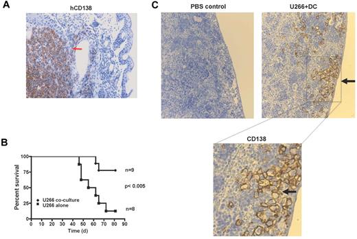 Figure 5. Effect of AID-mediated genomic damage on tumorigenicity of cells in immune-deficient mice. Eight-week-old female NSG mice were injected intravenously with 1 × 106 U266 cells per mouse, either U266 alone or re-isolated after coculture with DCs (U266 coculture) as in Figure 1A. Mice were killed when they had palpable tumors or showed other disease symptoms, including hunched posture, failure to eat and drink, and paralysis. (A) IHC analysis of tumor mass in a mouse injected with control tumor cells showing presence of CD138+ tumor cells. (B) Survival curve of mice injected with tumor cells alone or those previously exposed to DCs. (C) Detection of hCD138+ tumor cells in the spleen of mice injected with tumor cells previously exposed to DCs and PBS control. Bottom panel represents a higher magnification.