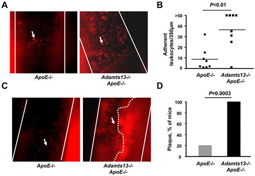 Figure 1. ADAMTS13 deficiency promotes excessive leukocyte adhesion and spontaneous plaque formation in the carotid sinus. (A) Representative photomicrographs of adhering leukocytes (> 60 seconds) at the carotid sinus, a lesion-prone site, as visualized by intravital upright microscope. Endogenous leukocytes were labeled with rhodamine 6G. White lines indicate the arteries; and arrows, adherent leukocyte. Original magnification ×200. (B) Dot plot shows the number of adherent leukocytes of each genotype (N = 8/group). Each dot represents a single mouse. Horizontal bars represent mean values. (C) Representative photomicrographs of spontaneous plaque formation as visualized by intravital upright microscope. Leukocytes were labeled with rhodamine 6G. White lines indicate the arteries; arrows, adherent leukocyte; and white dotted line, the spontaneous plaque, which occluded the vessel by approximately 70% to 80% (supplemental Video 4, available on the Blood Web site; see the Supplemental Materials link at the top of the online article). (D) The percentage of mice with a spontaneous plaque at the carotid sinus (N = 10/group).