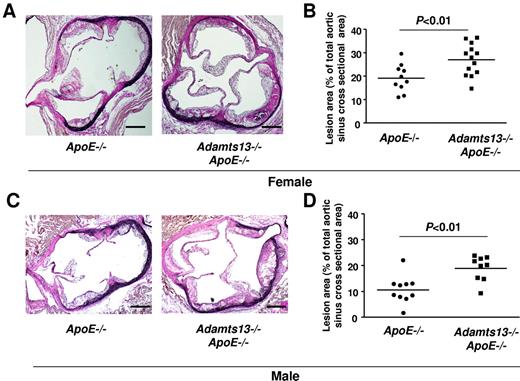 Figure 3. ADAMTS13 deficiency accelerates atherosclerosis in the aortic sinus. (A) Representative photomicrographs of VerHoeffs/Van Geison-stained aortic sinuses from female mice on a high-fat Western diet beginning at 6 weeks until they were killed at 4 months of age (ie, 10 weeks on high-fat Western diet). Bar represents 200μm. (B) Quantification of lesion in the cross-sectional area of aortic sinuses from female mice (N = 10-13/group). (C) Representative photomicrographs of VerHoeffs/Van Geison–stained aortic sinuses from male mice on a high-fat Western diet as described for female. Bar represents 200 μm. (D) Quantification of lesion in the cross-sectional area of aortic sinuses from male mice (N = 9 or 10/group). Each dot represents a single mouse. Horizontal bars represent mean values.