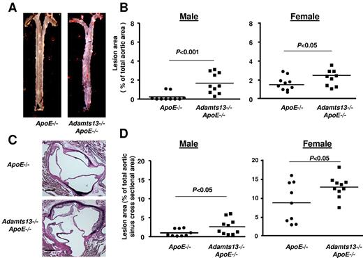 Figure 5. ADAMTS13 deficiency exacerbates atherosclerosis in ApoE−/− mice fed a normal chow diet. (A) Representative Oil red O-stained aortae from ApoE−/− and Adamts13−/−/ApoE−/− male mice fed a normal chow diet until 4 months of age. (B) Quantification of en face lesion area in the aorta (N = 10/group). (C) Representative photomicrographs of VerHoeffs/Van Geison-stained aortic sinuses from ApoE−/− and Adamts13−/−/ApoE−/− male mice fed a normal chow diet until 4 months of age. Bar represents 200 μm. (D) Quantification of lesion area in the cross sections of aortic sinus (N = 9 or 10/group). Each dot represents a single mouse. Horizontal bars represent mean values.