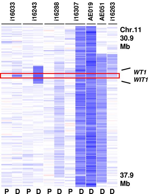 Figure 3. Recurrent deletions at 11p13. The MDR (130 Kb in size) is defined by case i16033 and contains the WT1 and the WIT1 gene (P indicates paired normal; and D, diagnosis).