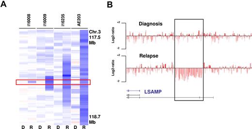 Figure 5. Relapse-associated deletions at 3q13.31 in 4 paired analyzed cases. (A) The MDR is defined by case i16008 that carries a deletion of 46 Kb containing a LSAMP transcript (R indicates relapse; and D, diagnosis). (B) SNP coverage of the locus in case i16008.