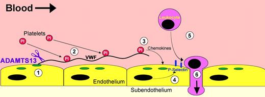 Proinflammatory VWF strings. Hypothetical mechanism through which ADAMTS13 deficiency promotes leukocyte adhesion and extravasation. (1) Endothelial cells at atherosclerosis-prone sites become activated and induce the release of UL-VWF from Weibel-Palade bodies (green). (2) A proportion of the UL-VWF that is secreted remains attached to the endothelium, where it unravels and tethers platelets. (3) Retention of platelets over the endothelial surface promotes the release of a variety of different chemokines that (4) act on the endothelium, thereby inducing the expression of adhesion molecules like P-selectin (blue). (5) P-selectin promotes rolling and adhesion of circulating leukocytes, which in turn can (6) extravasate into the subendothelial layers. In the presence of ADAMTS13 (purple), VWF strings are rapidly proteolysed from the endothelial surface to prevent this proinflammatory sequence.