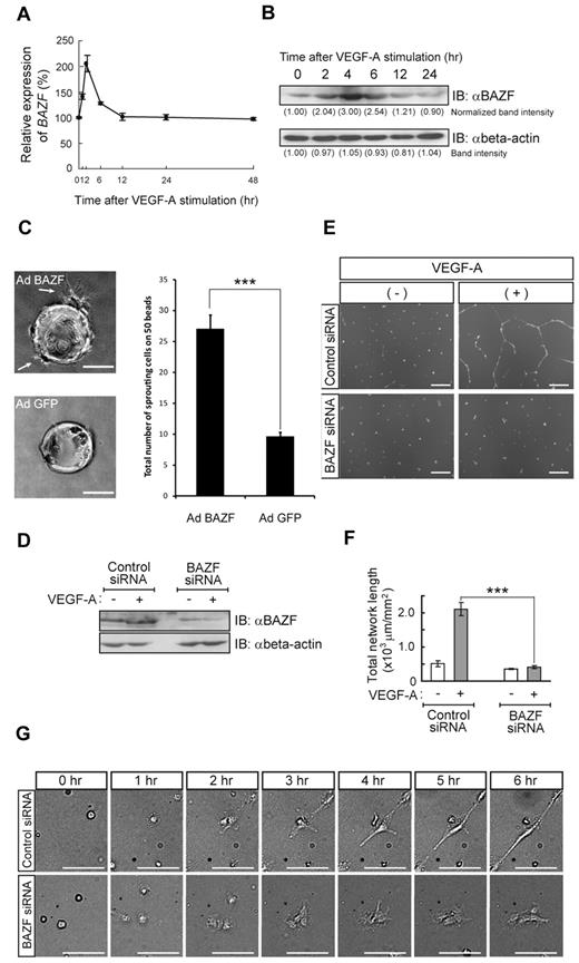 Figure 1. BAZF regulates EC network formation in culture. (A) Expression pattern of BAZF mRNA after VEGF-A (50 ng/mL) stimulation in HUVECs. Quantitative RT-PCR of BAZF mRNA was performed using a TaqMan-gene expression system. The results represent mean values from 3 independent experiments. Error bars represent ± SD. (B) Analysis of BAZF protein level in HUVECs after VEGF-A stimulation by Western blotting using an anti-BAZF antibody. Relative intensity of each band was measured by Lane Analyzer 3.0 software (ATTO) and normalized relative to β-actin (loading control). (C) Angiogenic sprouting from AdBAZF-infected or AdGFP-infected HUVECs. Arrows show sprouting cells. Left panels represent microscopic images, and right panel shows total number of sprouting cells in 50 beads. Scale bar: 100 μm (***P < .001). (D) Protein level of BAZF in HUVEC transfected with BAZF or control siRNA with or without VEGF-A stimulation. BAZF protein was detected by Western blotting using an anti-BAZF antibody. (E) BAZF knockdown disrupts VEGF-A–induced network formation of HUVECs on the Matrigel. The cells were stained with Calcein-AM and the images were acquired. Scale bar: 500 μm. (F) Quantification of the network formation of HUVEC transfected with BAZF or control siRNA. The total length of the network per field (mm2) was measured by ImagePro Plus software 4.5. (Roper). The results represent mean values from 3 experiments. Error bars represent ± SD (***P < .001). (G) Time-lapse imaging of the network formation in HUVEC treated with BAZF or control siRNA. Scale bar: 10 μm.