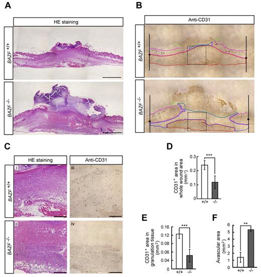 Figure 6. Impaired angiogenesis in skin wounded BAZF−/− mice. Eight-mm punch biopsies were made in the skin of the backs of 8 to 9-week-old BAZF+/+ or BAZF−/− mice. (A) H&E staining of wound section in BAZF+/+ and BAZF−/− mice at day 7. Scale bar: 2 mm. (B) Anti-CD31 staining of serial section in panel A. Green line: border of scab, magenta line: border of skin tissue, blue line: border of avascular area, red line: vascularized area in granulation tissue. (C) Magnified images of dot square regions in Figure 6B. Subpanels i and ii: H&E staining, iii and iv: anti-CD31 staining. Scale bar: 400 μm. Quantitative analysis of CD31+ area in whole wound area (D), CD31+ area in granulation tissue (E), and avascular area (F) in wound section of BAZF+/+ (n = 3) and BAZF−/− (n = 3) mice was carried out using ImagePro Plus 4.5.1.