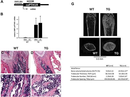 Figure 1. Targeted activation of PTH1R in osteocytes increases osteoblastic cells and trabecular bone. (A) Schematic representation of the transgene construct. (B) Expression of the transgene in tibia and lumbar spine of mice at 3.5 weeks of age. (C-D) H&E staining of longitudinal sections of representative distal femora from 3.5-week-old WT (C,E) and TG (D,F) littermate mice. Bars indicate 0.2 mm (C-D) and 0.05 mm (E-F). *P < .001. (C) Representative longitudinal and cross-sectional micro-CT images of distal femora from 4-week-old WT and TG littermate mice. Table insert includes quantification of micro-CT parameters (mean ± SD) from 3 female and 1 male mice in each group, age 3.5 weeks. *P ≤ .05