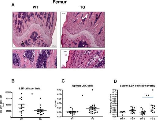 Figure 4. Mild versus severe hematopoietic phenotype in subsets of TG mice. (A-B) H&E staining of longitudinal sections of representative distal femora (A) from 4-week-old WT and TG littermates. Bars indicate 0.2 mm (low power) and 0.1 mm (high power). Quantification of LSK cells per limb (obtained by flushing 1 femur and 1 tibia per individual mouse limb, B) and frequency of spleen LSK cells (C). Spleen LSK-cell frequencies are also depicted by litter (D), demonstrating a mild (TG-A) and severe (TG-B) phenotype. Bars indicate mean and SEM. *P ≤ .05; **P ≤ .01.