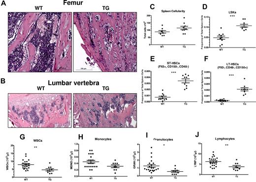 Figure 7. Progression of bone phenotype in TG mice results in neutropenia and dramatically increased LSK cells, pST-HSCs, and pLT-HSCs in spleens. (A-B) H&E staining of longitudinal sections of representative distal femora (A) and lumbar vertebrae (B) from 8-week-old WT and TG littermate mice. Bars indicate 0.2 mm (low power) and 0.1 mm (high power). Quantification of spleen cellularity (C), frequency of spleen LSK cells (D), pST-HSCs (E), and pLT-HSCs (F) from 8-week-old WT and TG littermate mice. Quantification of blood WBC (G), monocyte (H), granulocyte (I), and lymphocyte (J) counts in male and female WT and TG littermate mice. Each dot represents an individual mouse. Bar indicates the mean and SEM. *P ≤ .05; **P ≤ .01; ***P ≤ .001.