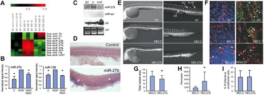 Figure 1. miR-27b controls vascular sprouting. (A) RNA was isolated from human microvascular endothelial cells grown in control medium (C, control), treated with VEGF (1-10 ng/mL) or VEGF + PEDF (10nM) and subjected to miRNA array analysis. A fragment of miRNA array shows the opposing effect of VEGF and PEDF on the expression of select miRNA (P < .05 by the 1-tailed Student t test). (B) Real-time RT-PCR was performed with primers for miR-27b (left panel) and miR-126 (right panel), with Let-7a as an internal control. (C) Northern blot was probed for indicated miRNA or U6 RNA to assess loading. The UV image is shown. (D) Whole-mount in situ hybridization for pri-miR-27b. The sense strand probe was used as a negative control (top panel). (E) Fertilized Tg(fli1a:EGFP)y1 zebrafish eggs were injected with MOs against miR-27b (MO-27b), control MOs (MO-C), or left untreated (NT). The embryos were photographed at 24 hpf. (F) Mice with subcutaneous LLC tumor xenografts (5-7 mm in diameter) were treated with daily intratumoral injections of MO-C or MO-27b (12.5 mg/kg). After 5 days, the tumors were excised, sectioned, and stained for the endothelial marker CD31 (red) and the proliferation marker Ki67 (green). Nuclei were counterstained with 4′,6-diamidino-2-phenylindole (blue). Arrowheads indicate proliferating endothelial cells. (G-I) Experiments shown in panel F were subjected to morphometric analysis with MetaMorph software. *P < .03 (G) and P < .003 (H). No significant difference was noted in panel I, with P = .47 by the 1-tailed Student t test.