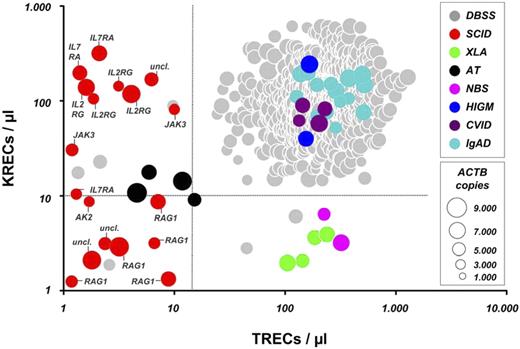 Figure 1. TREC and KREC copy numbers in dried blood spot samples (DBSS) from anonymized Guthrie cards and retested samples and in patients diagnosed with SCID, XLA, AT, NBS, X-HIGM, CVID, or IgAD. Dot size correlates with the amount of ACTB per sample. Dashed lines represent cutoff values for TRECs/μL and KRECs/μL, respectively. Proven molecular defects in the shown SCID patients are depicted as follows: RAG1 indicates recombination activating gene 1; IL2RG, interleukin 2 receptor γ chain (X-SCID); AK2, adenylate kinase 2; IL7RA, interleukin 7 receptor subunit α; JAK3, Janus kinase 3; and uncl., unclassified defect.