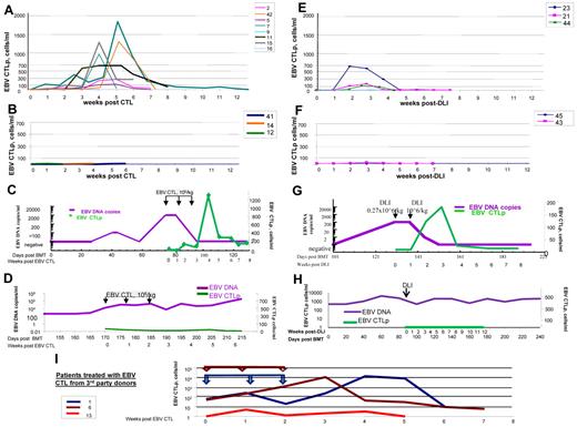 Figure 2. Monitoring of EBV-specific T cells in the circulation of patients with EBV-LPD treated with EBV-specific T cells or unstimulated DLIs. (A) Frequencies of EBV-specific T cells observed over a period of 12 weeks after initiation of T-cell therapy in the peripheral blood of patients who responded to treatment with EBV-specific T cells obtained from their stem cell donors (n = 8 patients evaluated). (B) Frequencies of EBV-specific T cells observed in peripheral blood of the patients with EBV-LPD who did not respond to treatment with EBV-specific T cells (n = 3) generated from PBMCs of their stem cell donors. (C) Monitoring of the EBV DNA levels (purple line) and EBV-CTLps (green line) of patient 15, who responded to treatment with EBV-specific T cells derived from the stem cell donor. EBV-CTLs were infused weekly for 3 consecutive weeks at doses of 1 × 106 cells/kg/infusion. After infusions of T cells, EBV-CTLps increased in frequency. Concurrently, EBV DNA levels in the peripheral blood of the patient decreased. (D) Monitoring of the EBV DNA levels (purple line) and EBV-CTLps (green line) of patient 41 who did not respond to treatment with EBV-specific T cells derived from the stem cell donor. EBV-CTLs were infused weekly for 3 consecutive weeks at doses of 1 × 106 cells/kg/infusion. No increase in EBV-CTLp frequency was observed over the period of 6 weeks of observation and the levels of EBV DNA remained high. (E) EBV-CTLps in patients who responded to therapy with DLIs from their HLA-matched stem cell donors (n = 3 patients evaluated). (F) EBV-CTLps in patients who did not respond to the therapy with DLIs (patients 43 and 45). (G-H) EBV DNA levels (purple line) and EBV-specific CTLps (green line) in the peripheral blood of patient 21, who responded to DLI treatment (G) and patient 45, who did not respond to the infusion of DLIs (H). (J) Monitoring of T-cell responses in the peripheral blood of patients with EBV-LPD who received EBV-specific T cells generated from third-party healthy donors (n = 5). The arrows indicate the times of the T-cell infusions for each of 3 patients treated and are presented in the same color as the line demonstrating the CTLps frequencies. Patients 1 and 6 achieved CR; patient 13 did not respond and died of PD.