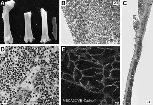 Figure 1. BM plug isolation and histologic assessment of intact vascular structures in BM plugs. (A) Representative images of denuded bones, removal of metaphysis, and isolated intact BM plug. (B-D) Resin-embedded sections of BM plugs (B,D) and remaining bone tissue (mid-diaphysis; C) after removal of marrow plug were sectioned as 5-μm-thick longitudinal sections and stained with hematoxylin and eosin, demonstrating intact vascular structures. (E) Whole-mount image of BM plug stained with a combination of the endothelial cell-reactive antibodies MECA32 and VE-Cadherin reveals a well-organized vascular reticulum throughout the marrow. BM plugs were stained with DRAQ5 to provide a nuclear counterstain and then immersed in prolong gold anti-fade mounting medium (Invitrogen). After applying a glass coverslip and sealing with nail hardener, specimens were inverted and allowed to cure overnight in the dark at room temperature before confocal imaging. Images were collected using 63× oil immersion objective of a Leica TCS SP5 confocal microscope and processed with the Leica LAS AF lite Version 2.6.7266 software. Z-stacked images were collected in 0.2-μm slices at depths of 15 to 25 μm with a pinhole of 1 (×63).