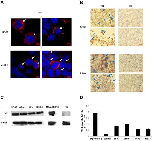 Figure 1. Tissue TG2 is expressed in MCL. (A) Immunocytochemistry analyses showed that the MCL cell lines SP-53 and Jeko-1 were positive for TG2 expression. Confocal microscopic images showed the localization of TG2 in the cytoplasm in MCL cells. Arrows in each panel indicate representative signals. (B) Xenograft tumor and spleen sections generated from sorted CD45+CD19− MCL-ICs were immunostained for TG2 protein expression. Representative sections with positive immunostaining for the anti–human TG2 Ab and the anti–human IgG Ab as a control are shown. The xenograft tumors and spleens expressed high levels of human TG2 (arrows). At least 5 sections from each xenograft tumor were analyzed. (C) Immunoblot analyses of TG2 expression were performed using cell lysate proteins of 4 different MCL cell lines, SP-53, Jeko-1, Mino, and REC-1. The breast cancer cell line MDA-MB-231 was used as a positive control and normal B cells were used as negative controls. β-actin was also used as a control. TG2 was expressed in MCL cells. (D) TG2 enzymatic activity was measured using TG2-CovTest TG2-specific colorimetric assay kit (Novus Biologicals) using extracts from SP-53, Jeko-1, Mino, and REC-1 cells. Recombinant human TG2 was used as a positive control, and normal B cells were used as negative controls. Comparable levels of enzymatic activities were noted between the different MCL cell lines.