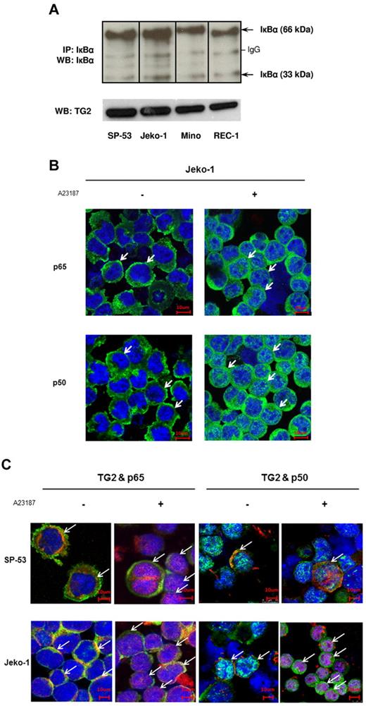 Figure 2. TG2 is associated with NF-κB expression in MCL. (A) Cell lysates from 4 different MCL cell lines, SP-53, Jeko-1, Mino, and REC-1, were immunoprecipitated and immunoblotted with an anti-IκBα Ab. Analysis indicated the presence of strong dimeric forms (66 kDa) and monomeric forms (33 kDa) of IκBα. The polymeric forms of IκBα persisted in TG2-expressed MCL cells. IP indicates immunoprecipitation; WB, Western blot. (B) TG2 activation induced NF-κB activation after translocation to the nucleus and increased the expression of NF-κB components in MCL cells. SP-53 and Jeko-1 cells were treated with A23187 (2μM for 24 hours), followed by immunochemical staining using anti-p65 and anti-p50 Abs. Confocal microscopic images revealed the translocation of NF-κB components p65 and p50 into the nucleus (arrows) in response to A23187 treatment. A further increase in the cytoplasmic intensity of p65 and p50 was clearly observed in Jeko-1 cells after A23187 treatment. (C) TG2 and NF-κB components were colocalized in MCL cells. Confocal microscopic images showed the colocalization of TG2 and NF-κB components p65 and p50 (arrows). Before treatment with A23187, TG2 (red) and the NF-κB components p65 or p50 (green) were located mainly in the cytoplasm. After A23187 treatment (2μM for 24 hours), simultaneous translocations of TG2 and the NF-κB components p65 or p50 were observed.