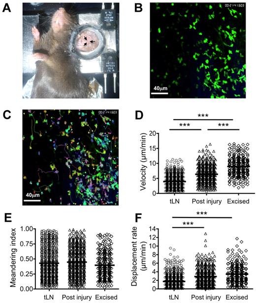 Figure 5. MPLSM of tLN. C57BL/6 LNs were engrafted to the ear pinnae of hCD2-GFP mice. Three to 4 weeks after engraftment, mice were anaesthetized, and the ear pinna was mounted on a heated stage (A). The tLN was then imaged by MPLSM without the need for surgical exposure (ie, through the intact ear). Recirculating GFP+ T cells in the tLN were imaged for ≤ 30 minutes (B), and cells were tracked (C) to allow calculation of velocity (D), meandering index (E), and displacement rate (F). After imaging the intact tLN, a surgical incision was made proximal to the engraftment area. After a period of 40 minutes, the tLN was imaged again, representing the LN after injury. Excised popliteal LNs from hCD2-GFP mice were imaged in a perfusion chamber as a control. Data represent tracks generated from 3 independent animals. Scale bars represent 40 μm. ***P < .001.