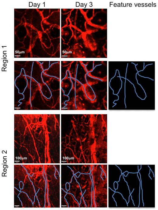 Figure 7. tLNs can be repeatedly imaged in the same area days apart. C57BL/6 LNs were engrafted to the ear pinnae of hCD2-GFP mice. Three to 4 weeks after engraftment, mice were anaesthetized, and the ear pinna was mounted on a heated stage. Vasculature was visualized with nontargeted Qdots (red). Several regions of the tLN were imaged where distinctive areas of vasculature were present. Two such areas are shown (Regions 1 and 2). Mice were then recovered and returned to the animal facility. Animals were then reimaged 3 days later. The same distinct areas of vasculature could be found in the naive tLN, confirming that the same area could be imaged longitudinally. Feature blood vessels are highlighted in blue. Scale bars in Region 1 images denote 50 μm. Scale bars in Region 2 images denote 100 μm. Images were acquired with a 10×/0.3NA air objective lens. Two representative regions are displayed from the same tLN.