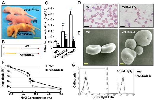 Figure 3. Abnormal appearance of V205GR characterized as spherocytic hemolytic anemia. (A) Macroscopic appearance of 3-day-old neonates. Note that V205GR-A neonate shows (lower pup) marked yellowish skin pallor compared with WT littermate (middle pup), whereas Gata1G1.05/X (upper pup) shows significant anemia. (B) Plasma color derived from WT (top) and V205GR-A (bottom). (C) Bilirubin concentration in the neonatal plasmas. Ten WT, 4 V205GR-A, and 3 V205GR-B neonates at the age of 2 to 3 days old were used for this experiment (open bars, total-bilirubin; filled bars, indirect-bilirubin; *P < .05, **P < .01). (D) Abnormal red blood cells in the blood smears. Various sizes of red cell fragments were observed in V205GR-A at 2 days old (right panel). The left panel is the WT control. Scale bars correspond to 20 μm. (E) Scanning electron microscopic analysis of erythrocytes prepared from V205GR-A newborn (right panel) and WT control (left panel). Scale bars correspond to 1 μm. (F) Osmotic fragility curves of erythrocytes from V205GR-B (black line) or WT (gray line) pups. Percent hemolysis was calculated for each solution based on the absorbance value obtained from 0.2% concentration. (G) ROS levels in erythrocytes of WT (dotted line) and V205GR-B (solid line) pups without (left panel) or with (right panel) addition of exogenous H2O2 (50μM).