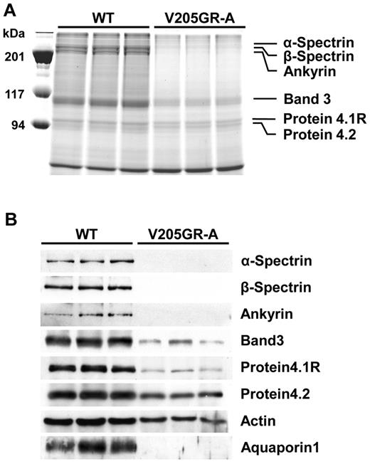Figure 4. Expression of majority of membrane proteins was reduced in V205GR erythrocytes. Coomassie brilliant blue-stained SDS-PAGE profile (A) and relative immunoblotting expression levels of erythroid membrane proteins (B) in red blood cell ghosts. Three WT and 3 V205GR-A newborn pups were used for this experiment. Loading volume was adjusted by the original number of erythrocytes used for preparation of cell ghosts.