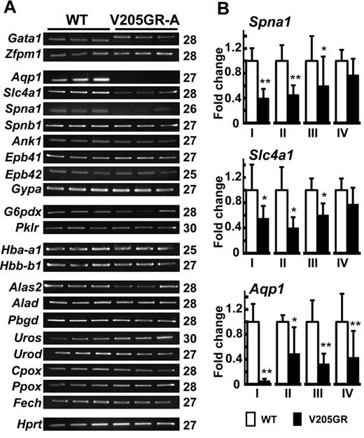 Figure 5. Expression of several genes coding for membrane proteins was selectively reduced in V205GR erythrocytes. (A) Expression of erythroid-related genes in V205GR-A TER119+ cells. Amplification cycles are shown in the right side of the figure. Note that the expressions of Spna1, Slc4a1, and Aqp1 genes were specifically reduced in V205GR-A. (B) Expression of Spna1, Slc4a1, and Aqp1 was analyzed by quantitative RT-PCR in erythroblasts TER119+ derived from E18.5 livers of V205GR-A (I), P2 spleens of V205GR-A (II), P3 spleens of V205GR-A (III), and P0 spleens of V205GR-B (IV). The values were represented as a mean of 3 independent age-matched and genotype-matched samples. The mean value of the transcripts in corresponding WT pups was set to one. (*P < .05, **P < .01)