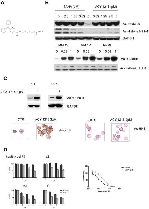 Figure 1. ACY-1215 selectively inhibits HDAC6. (A) Chemical structure of ACY-1215. (B) MM.1S cells were cultured with control medium or ACY-1215 (0-5μM) or SAHA (0-5μM) for 6 hours. MM.1S, MM.1R, and RPMI8226 cells were cultured with control medium or ACY-1215 (0.25 and 1μM) for 18 hours. (C) CD138+ patient cells were treated with control medium or ACY-1215 (2μM) for 4 hours. Whole-cell lysates were subjected to Western blotting using the indicated Abs. Increased acetylated α-tubulin was observed. CD138+ patient cells were fixed and double-stained for anti–human CD138+ and acetylated α-tubulin (left panel) and for anti–human CD138+ and acetyl-histone H3 (right panel). A significant increase in acetylation of α-tubulin was observed, whereas no significant difference was observed in the acetyl-histone H3 in the treated sample compared with control. (D) PBMCs from 4 healthy donors were stimulated with PHA and cultured with increasing doses (0-4μM) of ACY-1215 and SAHA for 48 hours. Cell growth was assessed by MTT assay (left panel). CD4+ T cells purified from human blood were stimulated by CD3/CD28 Dynabeads for 7 days in the presence of compounds. Cell viability was assessed using alamarBlue (right panel)
