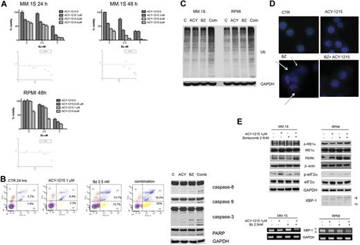 Figure 3. ACY-1215 in combination with bortezomib induces synergistic anti-MM activity. (A) MM.1S and RPMI8226 cells were cultured with bortezomib in the presence or absence of ACY-1215 (0-4μM) for 24 and 48 hours. Cytotoxicity was assayed by MTT. The isobologram analysis confirms the synergistic effect. (B) MM.1S cells were treated with ACY-1215 (1μM), bortezomib (2.5nM), or combined therapy for 24 hours, followed by annexin/PI staining and flow cytometry analysis (left). MM.1S cells were treated with ACY-1215 (1μM), bortezomib (2.5nM), or combined therapy for 16 hours. Whole-cell lysates were immunoblotted with the indicated Abs. (C) MM.1S cells were treated with ACY-1215 (3μM), bortezomib (2.5nM), or combined therapy for 24 hours. Whole-cell lysates were immunoblotted with the indicated Abs. (D) MM.1S cells were treated with ACY-1215 (1μM), bortezomib (2.5nM), or combined therapy for 12 hours. Cells were fixed and stained with 4′,6-diamidino-2-phenylindole (blue) and antiubiquitin Ab. The arrow indicates the ubiquitin-conjugated proteins. (E) MM.1S cells were treated with ACY-1215 (1μM), bortezomib (2.5nM), or combined therapy for 4 hours. Whole-cell lysates were immunoblotted with the indicated Abs. XBP-1 splicing was determined by WB and RT-PCR.