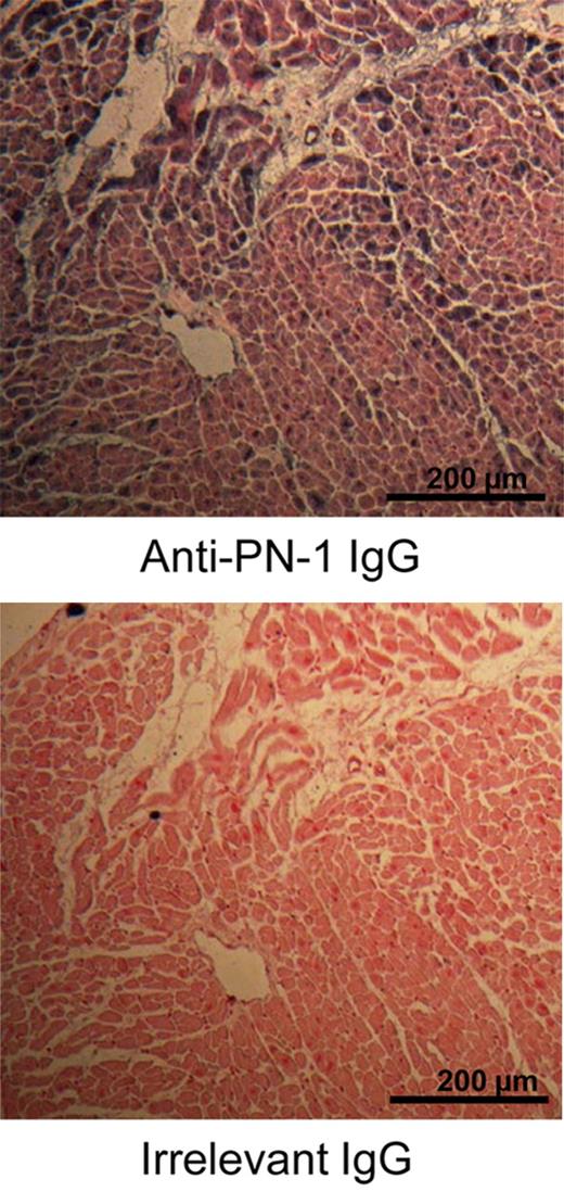 Figure 1. Immunohistochemical localization of PN-1 in human heart. PN-1 is homogeneously distributed in the myocardial tissue. A negative IgG control of PN-1 immunostaining was completely negative.