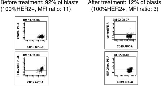 Figure 1. Using multiparameter flow cytometry, a CD19+CD45low blast cell gating strategy allowed to monitor blast population and HER2-positive expression after trastuzumab infusions. In this example of patient 1, HER2 expression became quasi-undetectable in bone marrow after 12 trastuzumab infusions.