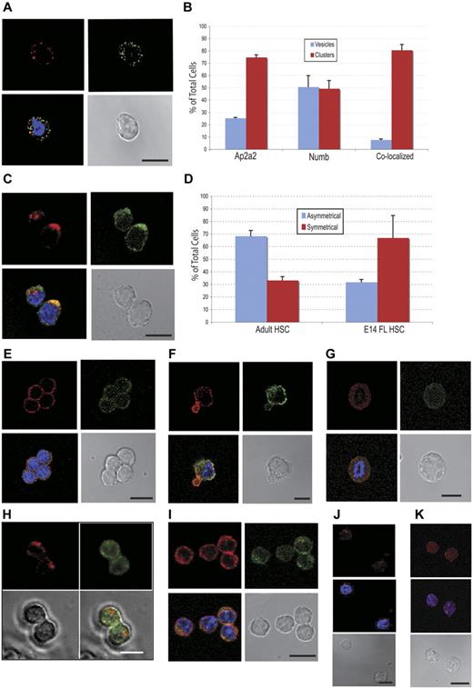 Figure 6. Endogenous AP2A2 localization in hematopoietic and leukemic cells. All subsequent cells stained for AP2A2 (Cy3-red), NUMB (FITC-green), and nucleus (DAPI-blue). (A) Adult CD150+48−LSK cell showing disparate AP2A2 and Numb vesicles. (B) Localization of endogenous AP2A2 and NUMB in CD 150+48−LSK HSCs. Definitions were as follows: vesicles, if vesicles are clear and distinct (see panel A); clusters, if any vesicles are coalesced (see panel C); colocalized, if vesicles or clusters are yellow when merged (see panels A and C). Total number of cells, N = 75. Colocalization percentage for vesicles, n = 39 cells; colocalization percentage for clusters, n = 36 cells. Values represent means ± SEM from 2 independent experiments. (C) Adult CD150+48−LSK cells showing asymmetric AP2A2 and NUMB clusters that are (lower cell) or not (top cell) colocalized. (D) Comparison of AP2A2 distribution in adult HSCs (n = 120 from 3 independent experiments) versus E14.5 FL HSCs (n = 127 from 2 independent experiments). Asymmetric defined arbitrarily as distinctly more AP2A2 vesicles on half of the HSCs in any plane (panels A and E are symmetric; panels C and F asymmetric). Values represent means ± SEM. (E) E14.5 FL CD150+48−Sca+Mac1+Lin− cells with symmetric distribution. (F) E14.5 CD150+48−Sca+Mac1+Lin− cell exhibiting asymmetric AP2A2 with symmetric NUMB. (G) A representative FL E14.5 CD150+48–Sca+Mac1+Lin− cell during mitosis showing endogenous AP2A2 and NUMB as diffusely symmetric vesicles that are essentially not colocalized (n = 7 cells in mitoses). (H) Still frames from live-cell videomicroscopy of representative adult CD150+48−LSK cell cotransduced with cherry-Ap2a2 (Cherry-red) and venus-Numb (FITC-green) constructs showing the absence of colocalization during mitosis. Total of n = 20 cells seen in mitoses. From 2 independent experiments, 17 of 20 cells (85%) seen in mitoses showed absence of colocalization. (I) FLA2 leukemia cells stained for Ap2A2 and NUMB. (J) Adult CD150+48− LSK cells transduced with vector alone and (K) HoxB4, then stained for AP2A2, (see supplemental Figure 2B). All confocal images were acquired with an inverted LSM 510 microscope (Carl Zeiss) using Planapochromat 63×/1.4 numerical oil lens objective (Carl Zeiss) and analyzed with LSM Version 3.2 software (Carl Zeiss). All scale bars indicate 10 μm.