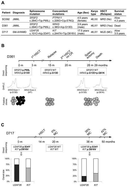 Figure 1. Spliceosome mutations and coexisting oncogenic mutations in children with MDS and JMML. (A) Mutations identified in 3 children. (B) Clinical timeline of patient D361. After second HSCT, the patient did not reach complete remission. Direct sequencing identified an SRSF2 mutation that was present only at diagnosis but was undetectable at later time points. A mutation in NRAS exon 1 (p.G13D) was detectable at all time points. In contrast, the mutation in NRAS exon 2 (p.Q61K) was present only at time of disease progression after second HSCT. This was confirmed by denaturing high-performance liquid chromatography. Bold lines represent patients' samples; and dashed lines, a wild-type control DNA. The picture at the bottom illustrates the hypothetical clonal evolution; black circles represent a clone carrying both the NRAS(p.G13D) and the SRSF2 mutation; gray circles, a primary clone harboring only the NRAS(p.G13D) mutation; and striped circles, a secondary clone with double NRAS mutation (p.G13D and p.Q61K). (C) Clinical timeline of patient D717. Mixed chimerism with 35% autologous cells occurred at 24 months after HSCT. Results from direct sequencing are presented within dashed boxes. The results from allele-specific clonal sequencing are shown at the bottom; the filled bars represent the proportion of mutant U2AF35 and KIT alleles. Twenty-three U2AF35 and 25 KIT subcloned alleles were sequenced in the diagnostic sample, and 25 U2AF35 and 31 KIT subcloned alleles were sequenced in the post-HSCT sample. SM-AHNMD indicates systemic mastocytosis associated with a clonal hematologic nonmast cell lineage disease; RCC, refractory cytopenia of childhood; CR, complete remission; DHPLC, denaturing high-performance liquid chromatography; MRD, matched related donor; MUD, matched unrelated donor; MC, mixed chimerism; and WT, wild-type.
