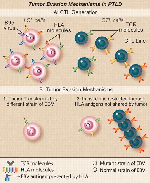 Tumor evasion mechanisms in PTLD. (A) Donor EBV CTLs are generated by stimulation with donor EBV-LCLs transformed with the B95 laboratory strain of EBV. TCRs in clones in the donor CTLs will recognize EBV peptides derived from antigens in B95 in the context of different donor HLA molecules. (B) Recipient tumors may fail to be susceptible to donor EBV CTLs if (1) the tumor cells are transformed with an EBV strain variant that differs from B95 so that the activity of the line is directed at epitopes found in B95 but not found in the tumor variant, (2) the activity in the line is restricted by an HLA type not found in the recipient that may occur if the recipient and the donor are mismatched and the PTLD is of recipient origin or if the donor is third-party and EBV activity is mediated through nonshared antigens. Professional illustration by Debra T. Dartez.