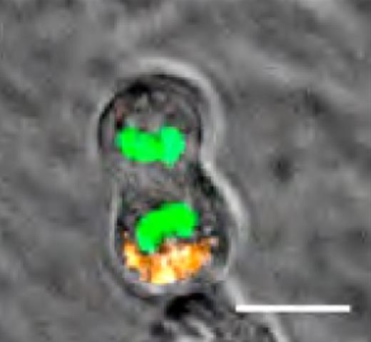 Asymmetrical segregation of AP2A2 during mitosis. CD150+48− LSK cells were transduced with an Ap2a2-Cherry fusion gene. Still frame from live cell videomicroscopy of dividing cells: DNA (Fitc-green); AP2A2 (Cherry-orange). Image from Ting et al.1