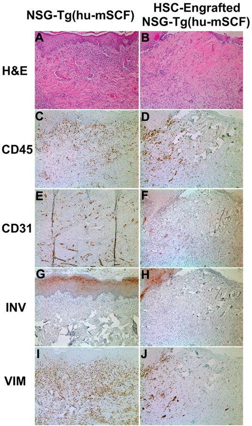 Figure 5. Skin transplantation on nonirradiated NSG-Tg(hu-mSCF) mice that were non-HSC–engrafted or engrafted with human HSCs as newborns. Nonirradiated NSG-Tg(hu-mSCF) mice were non-HSC–engrafted (left panels) or engrafted with human HSCs as newborns (right panels) as described in “Engraftment of mice with human HSCs.” At 12 to 14 weeks of age, all mice were transplanted and monitored for rejection of human skin allografts. Left side indicates the stain used for each row. (A-B) H&E indicates hematoxylin and eosin. (C-D) CD45 indicates all human hematolymphoid cells. (E-F) CD31 indicates human endothelium. (G-H) INV indicates human involucrin. (I-J) VIM indicates human vimentin.