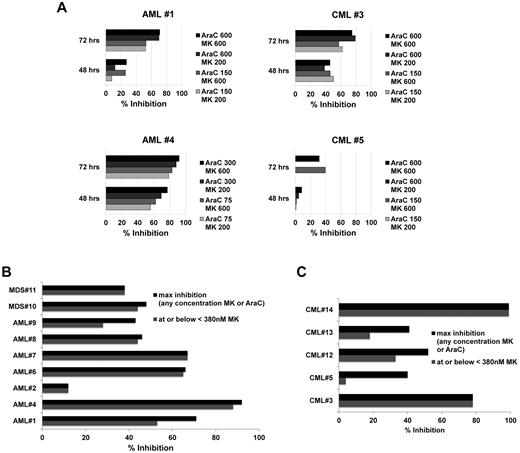 Figure 6. MK1775 is synergistic with Ara-C ex vivo. Percentage inhibition of relative cell number for the combination of Ara-C and MK1775 over Ara-C alone in primary AML, MDS, and CML patient samples. (A) Initial 4 (of 5) primary samples as described in the text. (B) AML and MDS primary samples. (C) CML primary samples. For panels B and C, the maximum percentage inhibition is shown for any concentration of MK1775 or Ara-C (darkly shaded bars) and for the greatest inhibition observed at or below 380nM MK1775 with any concentration of Ara-C (lightly shaded bars; see “MK1775 sensitizes primary AML, MDS, and CML specimens to Ara-C ex vivo” details).