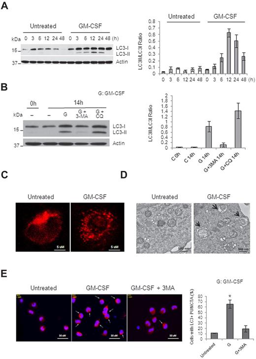 Figure 1. Autophagy is activated during human monocyte differentiation. (A-B) Immunoblot analysis of lysates from human primary elutriated monocytes incubated with or without GM-CSF (10nM) for the indicated times. (B) Where indicated, cells were pretreated with 3-MA at 10mM or CQ at 50μM. Representative data from at least 3 independent experiments for panels A and B are shown. The ratio of LC3II/LC3I was quantified from 3 experiments and is presented in bar graphs (A-B). (C) Human monocytes treated or not with GM-CSF for 14 hours, stained with anti-LC3 Ab and then Alexa Fluor 568 goat anti–mouse IgG (red), and processed for confocal microscopy. Scale bars indicate 5 μm. (D) Human monocytes were incubated with or without GM-CSF for 14 hours and processed for electron microscopy. Black arrows indicate autophagosomes with double membranes and partially degraded material. Scale bars indicate 500 nm. (E) Human monocytes were incubated with or without GM-CSF (10nM) in the absence or presence of 3-MA (10mM) for 14 hours, fixed, and stained with 4′,6-diamidino-2-phenylindole to visualize the nuclei (blue), and immunolabeled with an anti-LC3 Ab followed by 568 goat anti–mouse IgG (red). Scale bars indicate 20 μm. Representative images from 4 independent experiments are shown in panels B through D and quantitation of the percentage of cells with LC3+ punctate from the 4 experiments is shown in panel E (*P < .002 for comparisons between GM-CSF alone and untreated or cotreatment).