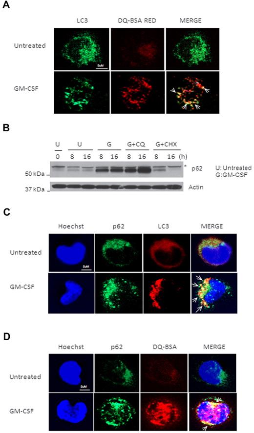Figure 3. p62 is colocalized with GM-CSF–induced LC3+ puncta and degraded by autophagy in activated monocytes. (A) Human primary monocytes were incubated with or without GM-CSF for 14 hours, and then treated with DQ-BSA for another 2 hours. Cells were fixed and stained with anti-LC3 Ab, followed by an FITC goat anti–mouse IgG (green). Representative confocal images of colocalization of LC3 and red fluorescence of DQ-BSA are shown. (B) Human primary monocytes were pretreated with cycloheximide (CHX) at 1μM or CQ at 50mM, and then incubated with GM-CSF (10nM) for the indicated times and analyzed by immunoblotting against p62. One representative experiment from at least 3 independent experiments is shown. Asterisk indicates one special band of truncated p62 Ab. (C) Human primary monocytes were incubated with or without GM-CSF for 14 hours, and then fixed and costained with anti-p62 Ab followed by a FITC goat anti–mouse IgG (green) and anti-LC3 Ab and then rhodamine goat anti–rabbit IgG (red). Representative confocal images of colocalization of p62 and LC3 are shown. (D) Human primary monocytes were incubated with or without GM-CSF for 14 hours and DQ-BSA for another 2 hours, then fixed and stained with anti-p62 Ab, followed by an FITC goat anti–mouse IgG (green). Representative confocal images of colocalization of p62 and red fluorescence of DQ-BSA are shown. Scale bars indicate 5 μm. Arrows indicate colocalization of green and red fluorescence (A,C,D).