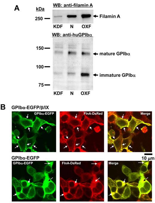 Figure 4. Reciprocal requirement for balanced expression of GPIbα and filamin for efficient trafficking to the plasma membrane. (A) Overexpression of filamin traps GPIbα in the ER and prevents its redistribution to the plasma membrane. Stable HEK293T cell lines were established in which filamin A was either knocked-down ∼ 90% (KDF), expressed at normal levels (N), or overexpressed 2 to 3-fold (OXF), as shown by filamin immunoblot analysis in the top panel. Each of these 3 cell lines were then transfected with a cDNA encoding GPIbα, and the ability of GPIbα to traffic from the ER to the cell surface evaluated by immunoblot analysis using an antibody that recognizes the extracellular domain of GPIbα. As shown in the bottom panel, cells expressing excess filamin (OXF) accumulated noticeably more GPIbα in the ER, as reported by the persistence of a lower, immature, Endo H-sensitive form of the subunit. Note that similar transfection efficiency was observed when GFP expression vector was transfected into these 3 cell lines. (B) Forced accumulation of GPIbα within the ER traps filamin and prevents its redistribution to the membrane skeleton of the cell. HEK293T cells that stably express FlnA-DsRed were transiently transfected with GPIbα-EGFP alone or together with GPIbβ and GPIX expression plasmids. Colocalization of GPIbα (green) with filamin A (red) was analyzed by confocal laser scanning microscopy. Top 3 panels: GPIbα, when expressed with the other subunits of the GPIb complex, becomes efficiently expressed on the cell surface, and chaperones filamin to the inner face of the plasma membrane. Bottom 3 panels: when expressed without GPIbβ and GPIX, GPIbα becomes largely trapped in the ER, trapping filamin as well, suggesting that they need to associate in nearly equimolar amounts for efficient trafficking of both components to the cell surface.