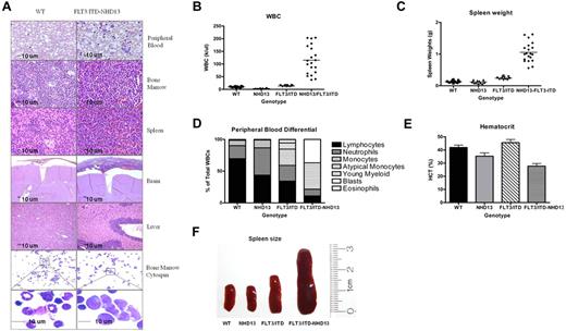 Figure 2. Organ histology and peripheral blood counts at 3-month time point. (A) The peripheral blood in FLT3/ITD-NHD13 mice contains numerous circulating blasts, and the normal bone marrow is replaced by sheets of blasts. Leukemic infiltrates are present in the spleen, brain, and liver. Bone marrow cytospins in the FLT3/ITD-NHD13 mice show abundant agranular blasts that have a scant to moderate amount of basophilic cytoplasm. Images for the modified Wright-Giemsa stain were acquired at room temperature using a Zeiss Axioskop upright microcope system (Carl Zeiss) with Achroplan 5×/0.16 NA, 10×/0.3 NA, and 40×/0.6 NA objectives and were photographed with an AxioCam camera (Carl Zeiss) and Axiovision Version 4.0 software (Carl Zeiss). (B) Comparison of WBC counts, (C) spleen weights, (D) differential count, (E) and hematocrit. (F) Example of spleen size in 3-month-old littermates representing each genotype.