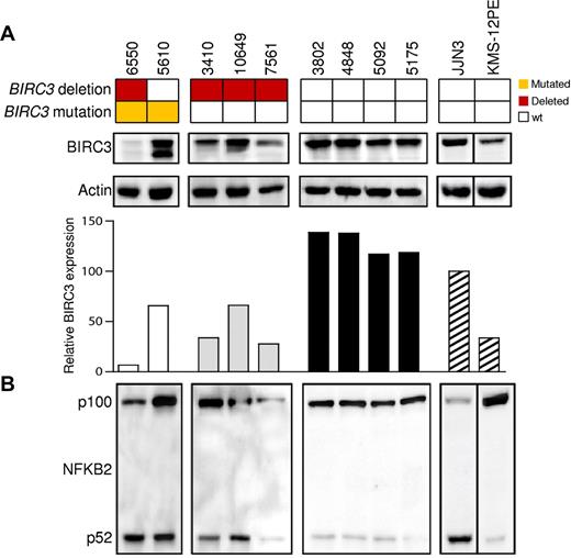 Figure 2. The NF-κB pathway is activated in CLL patients harboring BIRC3 disruption. Western blot analysis showing BIRC3 expression and NFKB2 processing in purified primary tumor cells from 9 CLL patients carrying wild-type or disrupted BIRC3. The JJN3 (plasma cell leukemia) cell line was used as a positive control for NFKB2 processing and BIRC3 expression. The KMS-12PE cell line (a multiple myeloma cell line) was used as a negative control for NFKB2 processing. Actin was used as a loading control. The histogram shows the relative fold change of BIRC3 expression compared with the BIRC3 expression level observed in the JJN3 cell line (arbitrarily set as 100). The aberrant BIRC3 bands in patients 6550 and 5610 correspond in size to the predicted BIRC3-truncated protein.