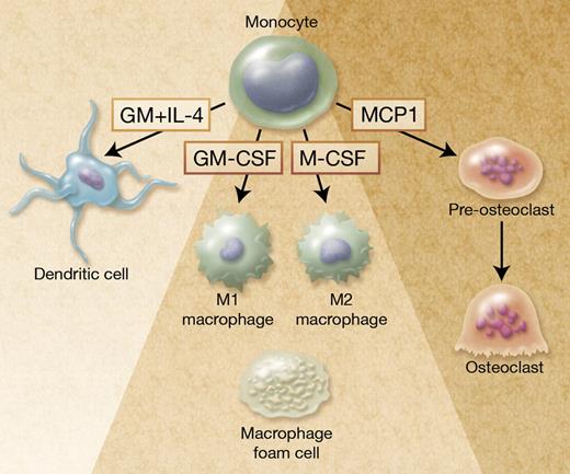 Autophagy in monocyte-derived cells. Monocytes are plastic cells that differentiate into M1-polarized macrophages on exposure to GM-CSF and M2-polarized macrophages on M-CSF exposure. Zhang et al report that autophagy is required for monocyte differentiation into macrophages and prevents cell death. Autophagy is also activated in monocytes exposed to GM-CSF and IL-4 to generate dendritic cells,1 and to MCP1 to generate pre-osteoclasts.9 In addition, autophagy is activated in lipid-loaded macrophages (foam cells) found in atherosclerotic lesions10 and in some infected macrophages to favor pathogen elimination and antigen presentation (not shown). Professional illustration by Alice Y. Chen.