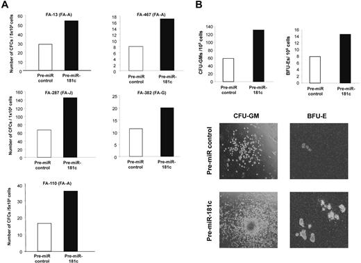 Figure 5. Pre-miR-181c improves the clonogenicity of hematopoietic progenitors from FA patients. (A) Analysis of the number of hematopoietic progenitors from FA patients cultured in methylcellulose 48 hours after transfection with a Pre-miR control (white bars) or with Pre-miR-181c (black bars). (B) Representative analysis of CFU-GM and BFU-E colonies corresponding to patient FA-287. Photographs are from patient FA-13.