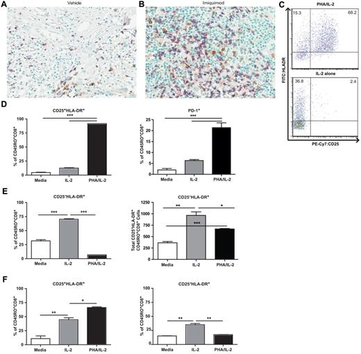 Figure 6. Human CD8 T cells exhibit similar phenotypic characteristics to mice after in vivo and in vitro antigen nonspecific stimulation. CD8 (purple) and CD25 (brown) expression in melanoma lesional biopsies after application of (A) vehicle or (B) 5% imiquimod cream daily for 14 days (40× magnification). (C) Dot plots depict gating schema and expression of HLA-DR and CD25 expression on human CD8+ T cells after 3 days of stimulation with PHA/IL-2 (TCR mimicking) or IL-2 alone in vitro. (D) Percentages of (TCR-dependent) CD25+HLA-DR+ (left) or PD-1+ (right) expressing CD45RO+CD8+ human T cells. (E) Percentage (left) and numbers (right) of CD25−HLA-DR+ (TCR-independently activated) human CD45RO+CD8+ T cells. (F) Percentages of CD25+ (left) and CD25− (right) human CD45RO+CD8+ T cells after 14 days of indicated stimulation. Data are representative of at least 2 independent experiments (*P < .05, **P < .01, ***P < .001).