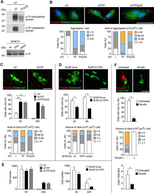 Figure 1. Clot formation induced by TF extracellular domain is essential for tumor cell survival. (A) Immunoblot detection of TF extracellular and cytoplasmic domains in extracts from human and murine melanoma cell lines. Representative Western blots from 3 independent experiments are shown. (B) Ex vivo assays of platelet aggregation. The 104 CMFDA-stained human melanoma cells (green) were seeded on collagen type I-biocoated multichamber slides. The 30 × 106 PKH26-stained platelets (red), isolated from SCID mice, were added and incubated for 2 hours. After fixation and 4,6-diamidino-2-phenylindole staining (blue), images were acquired with an epifluorescence microscope. Representative images of 1 of the 3 independent experiments performed are shown. Number and area of platelet aggregates associated with the cells were scored (15 cells per group were analyzed). (C-E) In vivo assays of clot formation (C-D) and cell survival assays (E). SCID (C and E left panels), Cx3cr1gfp/+ (D), or C57BL/6 (E right panel) mice were intravenously injected with 2.5 × 105 CMFDA-stained human melanoma cells (green, C and E left panels), or with 5 × 105 CMAC (green, D) or CMFDA (E right panel) stained murine melanoma cells and, on the opposite tail vein, with 9 × 109 PKH26-stained platelets (red), isolated from SCID (C) or C57BL/6 (D) mice. At the indicated times, lungs were isolated and imaged as intact organ with an epifluorescence (C,E) or a confocal (D) microscope. Representative images from the 2-hour time point, of 1 of the 3 independent experiments performed, are shown (C-D top panels). Tumor cell association with clots (C-D middle panels), the clot area or volume at the 2-hour time point (C-D bottom panels, ≥ 16 human and ≥ 30 murine cells with clot were analyzed), and the total number of tumor cells observed from images of consecutive fields of the entire left lobe of the lungs (E) were scored. n = 3 mice for panel C middle panel (1-way ANOVA and Tukey test for 2 hours, Mann-Whitney for 24 hours). n = 3 mice for panel D (middle panel; Mann-Whitney). n = 3 mice for panel E (1-way ANOVA, left panel 2 hours; Mann-Whitney, left panel 24 hours, and right panel). A χ2 test showed a significant correlation (P < 1.7 × 10−16) between clot formation at 2 hours (C middle panel) and cell survival at 24 hours (E left panel). (F) Cx3cr1gfp/+ mice were treated with hirudin (20 mg/kg), given intraperitoneally 5 minutes before and 4 hours after the intravenous injection of 5 × 105 CMAC-stained B16F10-wt cells (green) and, on the opposite tail vein, 9 × 109 PKH26-stained platelets (red), isolated from C57BL/6 mice. Lungs were isolated after 8 hours and imaged as intact organ with a confocal microscope. Percentage of tumor cells with clot, volume of the clots (≥ 15 cells with clot were analyzed), and the total number of tumor cells per field were scored; n = 3 mice (Mann-Whitney). (C-F) Data are mean + SD. *P < .05. **P < .01. (B-D,F) Scale bars represent 50 μm.