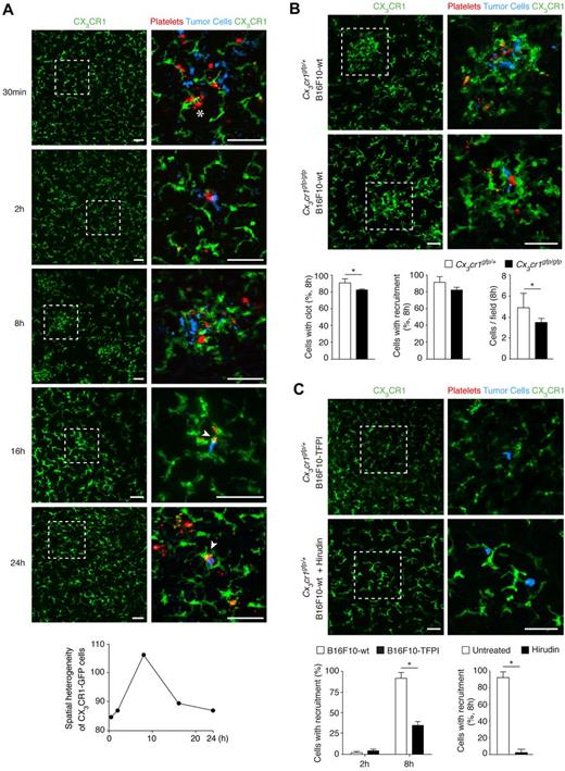 Figure 2. Recruitment of myeloid cells is mediated by tumor cell clot formation. (A) In vivo assays of myeloid cell (green) recruitment. Cx3cr1gfp/+ mice were intravenously injected with 5 × 105 CMAC-stained B16F10-wt cells (blue) and, on the opposite tail vein, with 9 × 109 PKH26-stained platelets (red), isolated from C57BL/6 mice. At the indicated times, lungs were isolated and imaged as intact organ with a confocal microscope. Arrowheads indicate direct contact between tumor cells and GFP+ cells. Occasionally, clots were also observed associated with myeloid cells (star). Representative images from 3 independent experiments performed per time point. Ripley test was performed to analyze clustering of CX3CR1-GFP cells during the time course. y-axis represents the sum of K(r)/area (r) (K = Ripley K, r = distance range 5-100 pixels). Clustering of CX3CR1-GFP cells around tumor cells, peaking at 8 hours, was observed in 2 other independent experiments. (B) The fractalkine receptor is not involved in recruitment to tumor cells. Cx3cr1gfp/+ (top panels) or Cx3cr1gfp/gfp mice (middle panels) were intravenously injected with 5 × 105 CMAC-stained B16F10-wt cells (blue) and, on the opposite tail vein, with 9 × 109 PKH26-stained platelets (red), isolated from C57BL/6 mice. At 8 hours, lungs were isolated and imaged as intact organ with a confocal microscope. Representative images from 3 independent experiments performed are shown. Clot formation on tumor cells, recruitment of myeloid cells (green), and number of tumor cells observed per field were scored; n = 3 mice (Mann-Whitney). (C) Clot formation is required for subsequent myeloid cell recruitment. Myeloid cell (green) recruitment to tumor cells was assessed from images obtained from experiments described in Figure 1D and F. Representative images with B16F10-TFPI cells (blue; red, platelets; 8 hours after injection; top panels) and hirudin-treated mice (20 mg/kg; blue, tumor cell; red, platelets; middle panels) from 3 independent experiments are shown. Recruitment of myeloid cells to B16F10-wt and B16F10-TFPI tumor cells was scored at the indicated times (bottom left panel); n = 3 mice (Mann-Whitney). Recruitment of myeloid cells to tumor cells was scored in hirudin-treated mice (bottom right panel); n = 3 mice (Mann-Whitney). Scale bars represent 50 μm. White boxes define areas enlarged at right. (B-C) Data are mean + SD. *P < .05.