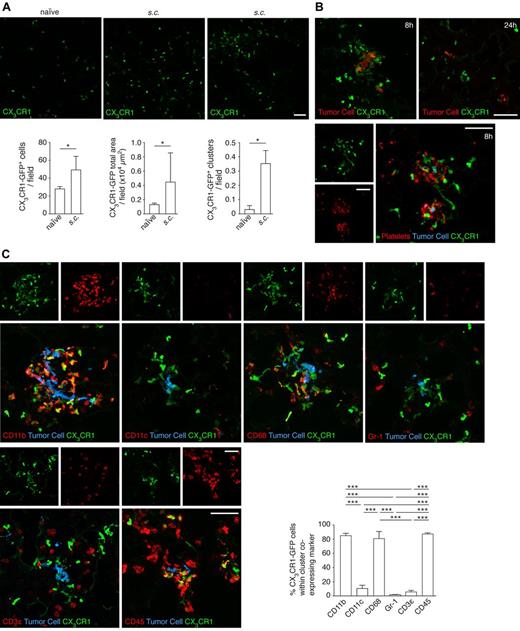 Figure 6. Characterization of the myeloid cells recruited to the premetastatic niche. (A) Cx3cr1gfp/+ mice were subcutaneously injected with 5 × 103 B16F10 cells. After 21 days, lungs were isolated and sections imaged with a confocal microscope (top panels) and scored by software for the number (bottom left) and area (bottom middle) of CX3CR1-GFP cells per field; n = 3 mice, ≥ 35 single fields analyzed per mouse (Mann-Whitney). The number of CX3CR1-GFP cell clusters (as seen in top right panel) per field was manually scored (bottom right); n = 3 mice, ≥ 35 single fields analyzed per mouse (Mann-Whitney). (B) Cx3cr1gfp/+ mice were intravenously injected with 5 × 105 CMRA-stained B16F10-wt cells after the establishment of the premetastatic niche, as described in panel A. Lungs, isolated either 8 or 24 hours after intravenous injection of tumor cells, were sectioned and directly imaged with a confocal microscope (top panels, tumor cell in red) or after immunohistochemistry (bottom panels) against the platelet-specific integrin αIIb (AlexaFluor-633, red; and tumor cells, blue; 8 hours only). Representative images from 3 independent experiments performed per time point are shown. (C) Immunohistochemistry of sections from panel B, imaged with a confocal microscope (8 hours after the intravenous injection of tumor cells) against CD11b, CD11c, CD68, Gr-1, CD3ϵ, and CD45 (AlexaFluor-633, red; and tumor cells, blue). The percentage of CX3CR1-GFP cells within the clusters that coexpressed the indicated markers was scored; n = 3 mice, ≥ 10 clusters analyzed per mouse (1-way ANOVA and Tukey test). Scale bars represent 50 μm. (A,C) Data are mean + SD. *P < .05. ***P < .001.