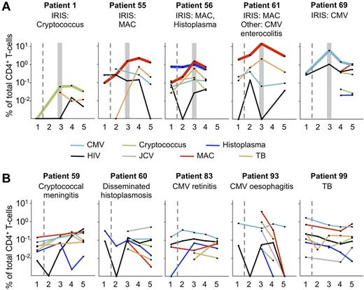 Figure 5. During ART, only frequencies of CD4+ cytokine-producing T cells specific to IRIS-associated Ags increase dramatically. PBMC samples from 5 IRIS patients (A) and 5 non-IRIS patients (B) were stimulated with MAC, H capsulatum, C neoformans, TB, CMV, JCV, or HIV-1. The IRIS-associated opportunistic infection and other known infecting pathogens tested for in the present assays are indicated for each patient. The number of stimulations performed with each PBMC sample was determined by the number of cells available, and priorities were given to those Ags to which a given patient was known to have been exposed. Gray boxes indicate the first time point within 3 months of clinical manifestation of IRIS. Dashed lines separate pre-ART from on-ART samples. Bold lines indicate T-cell responses to IRIS-associated Ags. IRIS patients were selected for illustration if stimulation data were available for at least 2 Ags and at least 4 time points. If 2 Ags fulfilled these criteria, all other stimulations with at least 2 data points were shown for that patient. Non-IRIS patients were selected according to the aforementioned criteria, as well as having known to be exposed to at least one of the Ags being tested: 1 indicates tp1; 2, tp2; 3, tp3; 4, tp4; and 5, tp5.