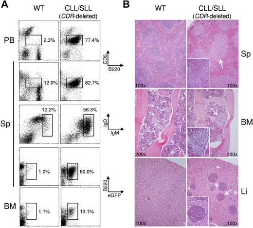 Figure 3. CDR-deleted mice develop CLL. (A) Flow cytometry of PBMC (PB), splenic (Sp), or BM cells from a mouse presenting with CLL/small cell lymphocytic leukemia (SLL) and a wild-type (WT) mouse as control for CD5 and the B-cell marker B220 (top), IgM and IgD (middle), and eGFP and B220 (bottom). The CLL/SLL case shows a predominant CD5+B220lo population in the spleen and PB that was IgMhiIgD+/low and eGFP+, demonstrating that the tumor clone is indeed derived from a CDR-deleted B cell. (B) Representative H&E–stained spleen, BM, and liver sections from CDR-deleted mice presenting with CLL/SLL (right) and an age-matched WT mouse (left). CLL/SLL section shows enlargement of the splenic white pulp by the expansion or accumulation of small B cells with architectural and morphologic features of CLL/SLL (top), aggregates of small lymphocytes in the BM (middle) and liver (bottom). Both flow cytometric and histological analysis were performed for all mice of the 15- to 18-month-old CDR cohort (for numbers of mice analyzed, see Figures 4 and 5; for details regarding micrographs, see “Cell isolation, flow cytometry, and histology”).