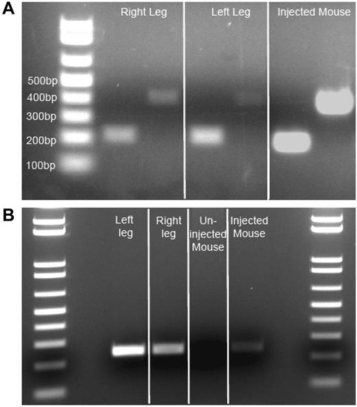 Figure 2. Evidence of F.IX RNA, AAV vector DNA in subject F muscle. (A) Evidence of active transcription of F.IX RNA. Two independent primer pair PCR amplifications (216-bp and 408-bp amplicons) specific for human F.IX cDNA on patient muscle cDNA derived from isolated RNA. Three-week post-AAV2-CMV-F.IX–injected mouse (C57BL/6) muscle RNA-derived cDNA serves as a positive control. (B) Evidence of AAV vector genome in patient muscle. Primers amplifying a 242-bp genomic DNA segment from the CMV promoter of the vector to the exon 1/intron 1 junction of the transgene cassette reveal persistence of vector in injected patient muscle DNA. Three-week post-AAV2-CMV-F.IX–injected quadriceps mouse muscle genomic DNA serves as a positive control, while the contralateral uninjected quadriceps muscle serves as a negative mouse control.