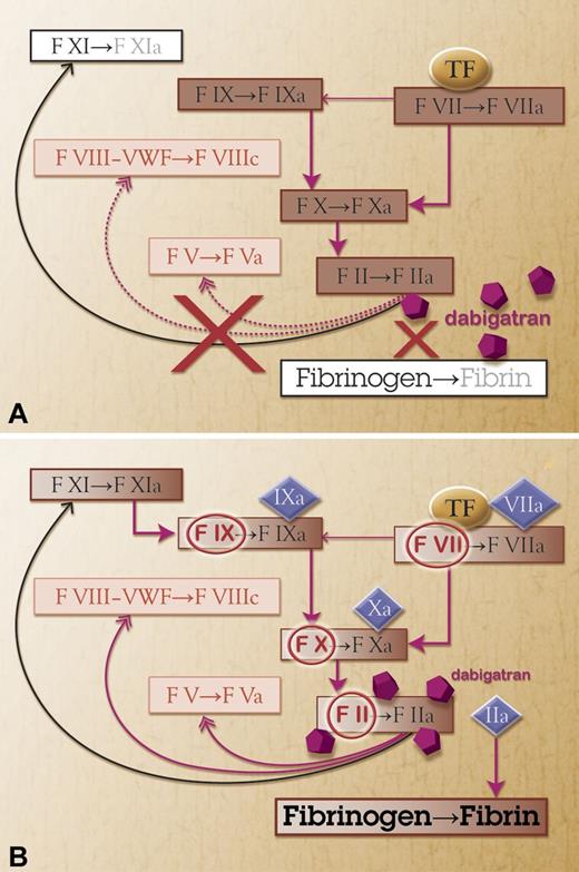 Figure 1. Possible reversal of dabigatran. (A) Treatment with a direct thrombin inhibitor (dabigatran) blocks factor IIa (thrombin) and thereby the fibrin formation. (B) Activated prothrombin complex concentrate provides additional factor II, VII, IX, and X (circled red) and also these factors in activated form (diamonds). Factor IIa may then overcome the thrombin inhibitor.