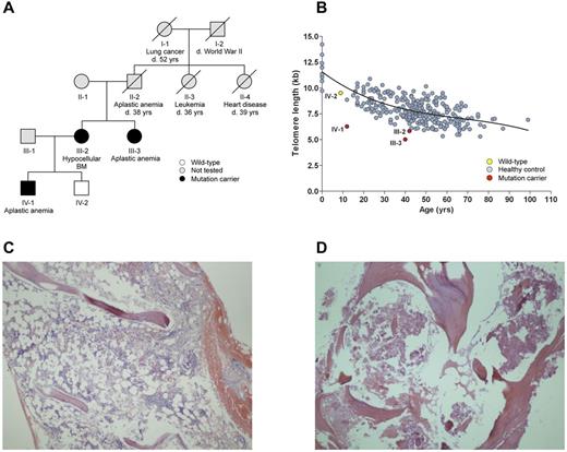 Figure 1. Pedigree, telomere length, and BM histology. (A) Pedigree of proband (III-3). Individuals II-2 and II-3 are suspected mutation carriers. Slashed symbols indicate deceased (d.) individuals. Neither the proband, her sister, or affected nephew showed abnormal pigmentation of the skin, nail dystrophy, or oral leukoplakia, nor was there evidence of pulmonary or immunologic problems, growth retardation, developmental delay, or microcephaly. During cholecystectomy, an enlarged liver was noticed in III-2; however, this finding was not further evaluated after surgery. (B) Blood leukocyte telomere length (in kilobases) as a function of age. Mutation carriers have very short telomeres in peripheral blood leukocytes. The curve marks the 50th percentile of telomere length for control subjects derived from 298 healthy National Institutes of Health blood bank donors. A sample's telomere length was expressed as a telomere to single-copy gene (T/S) ratio, which was converted to kilobases. BM biopsy showed profound hypocellularity in the proband (III-3; C) and hypocellular BM and eosinophilic ground substance in her sister (III-2; D).